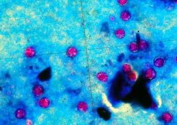 Cyclospora